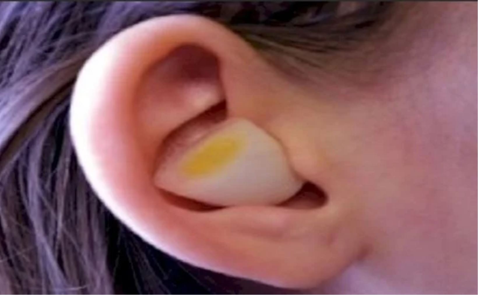 Hearing 02a